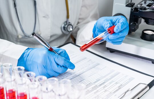Molekulare Marker und neue therapeutische Zielstrukturen bei inflammatorischer Kardiomyopathie