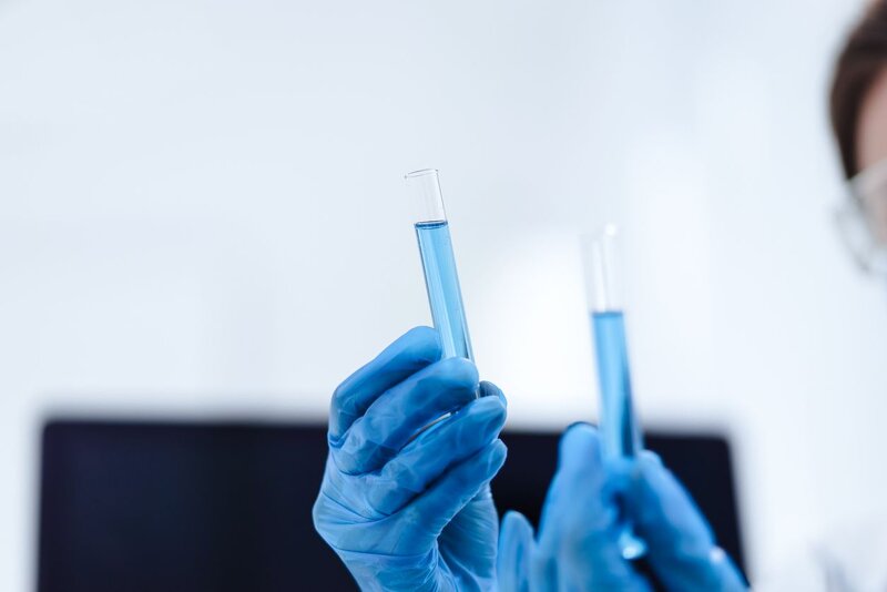  - Proteogenomische Erforschung von endothelialen Mikroproteinen bei kardiovaskulären Erkrankungen