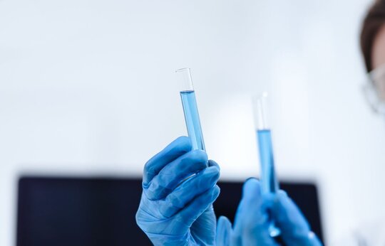 Proteogenomische Erforschung von endothelialen Mikroproteinen bei kardiovaskulären Erkrankungen