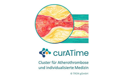 Illustration of a narrowed artery with deposits that impede blood flow. In the foreground is an enlarged view of the narrowing of the vessel, with the entire artery in the background. Below is the curATime logo with the words “Cluster for Atherothrombosis and Individualised Medicine”.