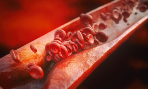 Illustration of red blood cells flowing through a narrowed artery, suggesting restricted blood flow due to plaque buildup.
