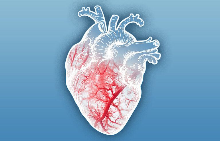 First prospective randomized trial to examine a differential therapeutic response in symptomatic patients with non-obstructive coronary artery disease after coronary physiological testing (EXAMINE-CAD-DZHK22)
