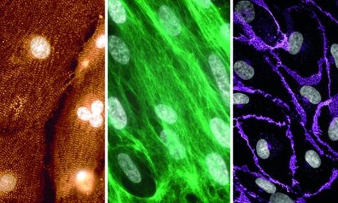 A three-panel fluorescence microscopy image of different cell types in the heart: on the left, an orange-brown image showing radially arranged fibrous structures and several bright, round cell nuclei (cardiomyocytes); in the  centre, elongated cells with a green-fluorescent cytoskeleton and cell nuclei shown in grey (cardiac fibroblasts); on the right, a  network of violet-fluorescent cell structures with scattered oval, grey-coloured cell nuclei (endothelial cells).