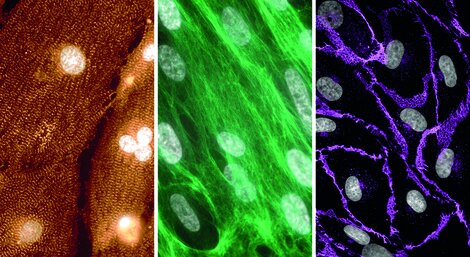 Dreigeteiltes fluoreszenzmikroskopisches Bild von verschiedene Zelltypen des Herzens: Links eine orange-braune  Aufnahme mit radial angeordneten faserartigen Strukturen und mehreren hellen, runden Zellkernen (Kardiomyozyten); in der  Mitte längliche Zellen mit grün fluoreszierendem Zytoskelett und grau dargestellten Zellkernen (kardiale Fibroblasten); rechts ein  Netzwerk violett fluoreszierender Zellstrukturen mit verstreut liegenden ovalen, grau gefärbten Zellkernen (Endothelzellen).